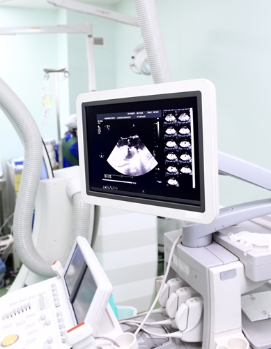 A view at a medical device that helps show ultrasounds on a screen.